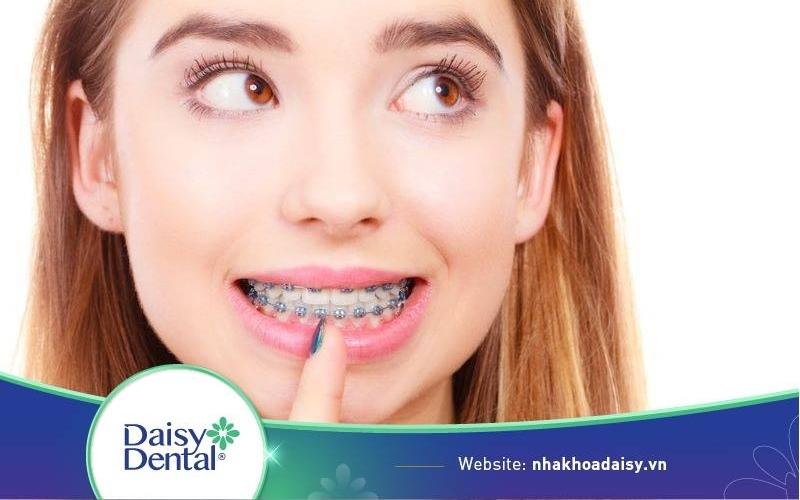nhổ răng để niềng có ảnh hưởng gì không
