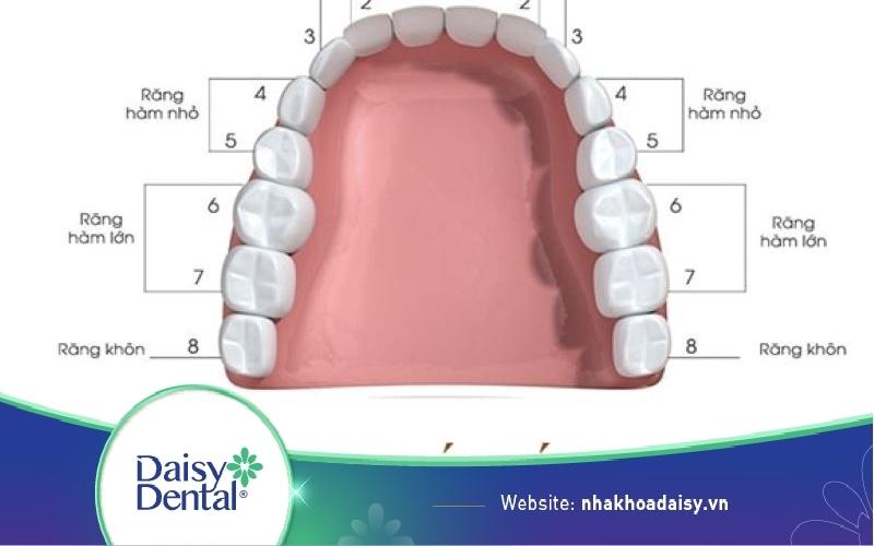 niềng răng nhổ răng số 4