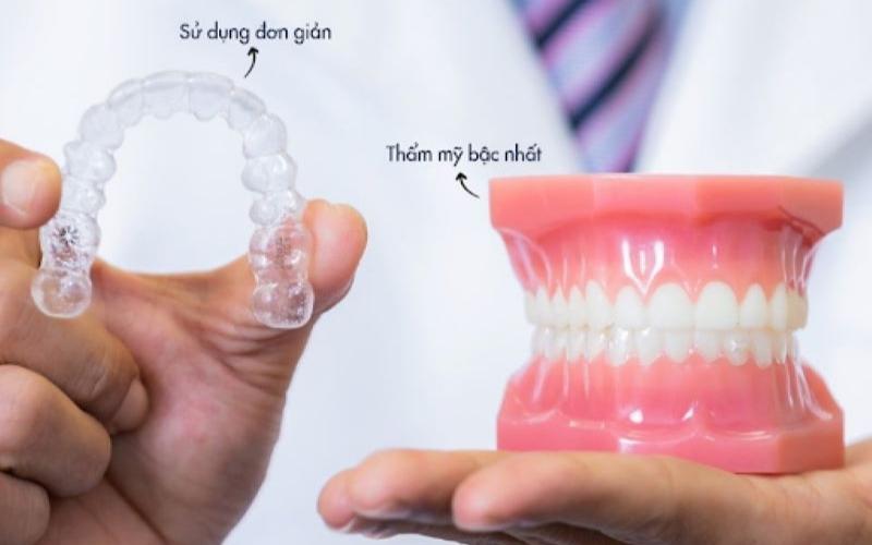 Phương pháp niềng răng không mắc cài dễ vệ sinh răng miệng