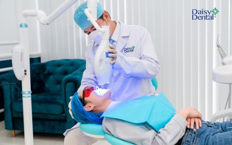 Tẩy tắng răng Cold Light Laser được đánh giá có hiệu quả lâu dài