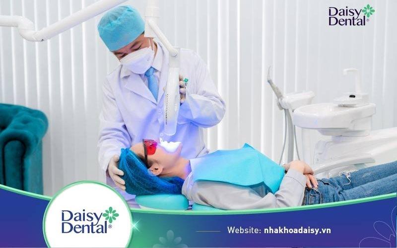Công nghệ tẩy trắng răng Bleachbright