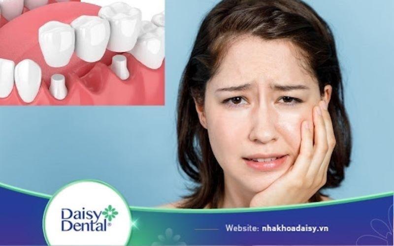 làm cầu răng sứ có đau không