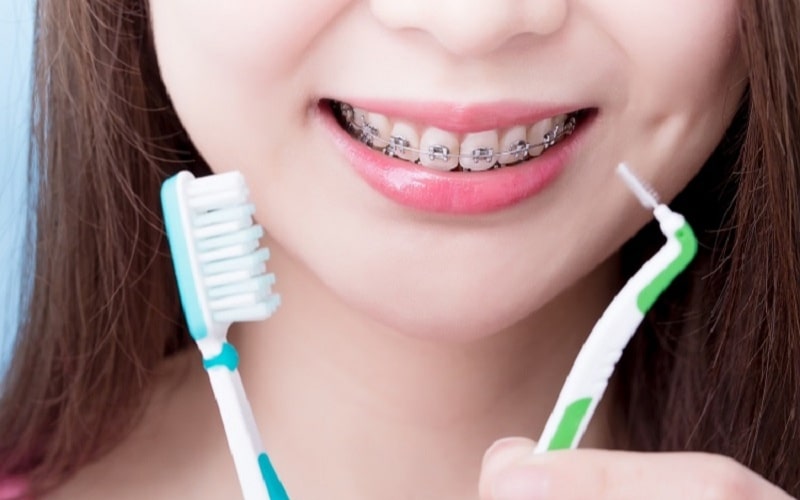 Nên sử dụng bàn chải khe răng sau khi đánh răng thông thường
