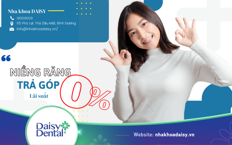 Niềng răng trả góp