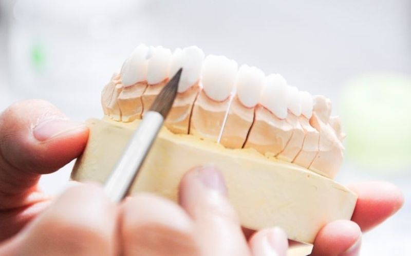 Bác sĩ sẽ kiểm tra tình trạng răng sứ, có thể vệ sinh và gắn lại hoặc thay thế bằng răng sứ mới
