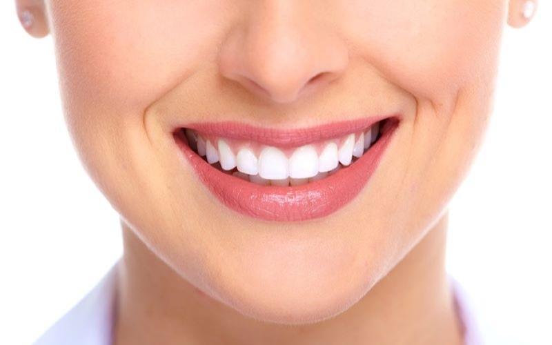 Tẩy trắng răng được bao lâu phụ thuộc vào nhiều yếu tố