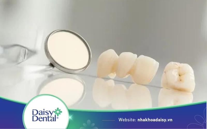 răng sứ bị xỉn màu