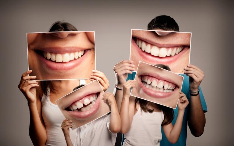 Tùy thuộc vào tình trạng răng miệng mà thời gian niềng sẽ khác nhau