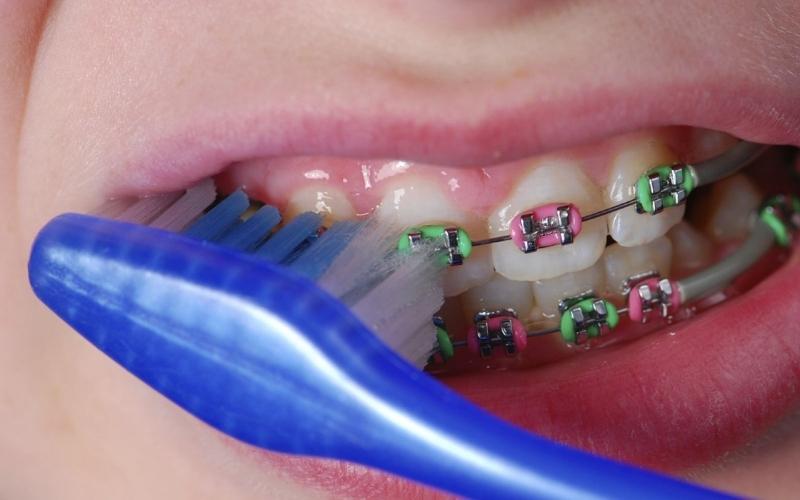 Vệ sinh răng miệng trước khi dùng sáp