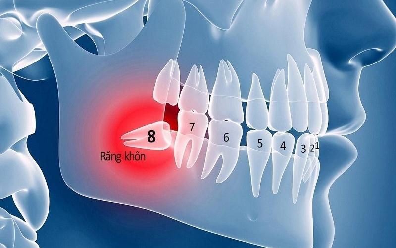 Răng cấm là các răng số 6 và số 7 trên cung hàm