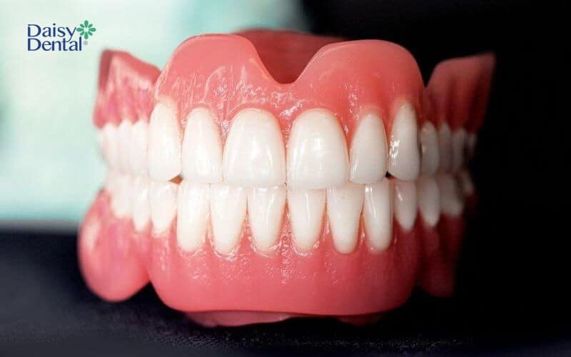 Bọc răng sứ có tính thẩm mỹ cao giúp bạn tự tin với nụ cười rạng rỡ