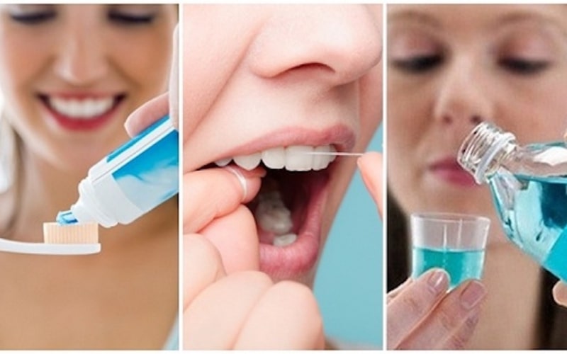 Chăm sóc răng miệng cẩn thận để bảo tồn tính thẩm mỹ của răng sứ