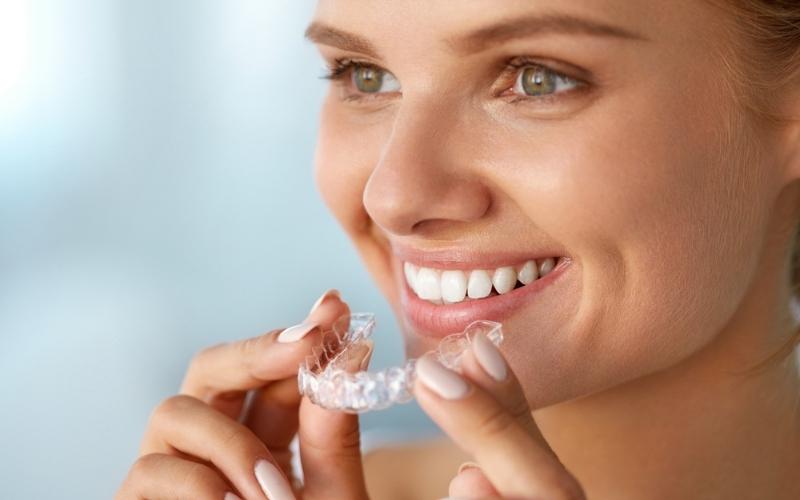 Máng tẩy trắng răng được sử dụng phổ biến hiện nay