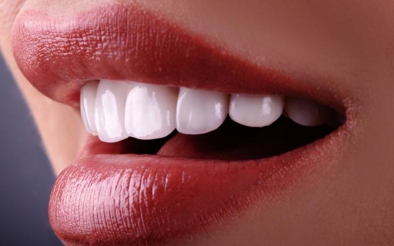 Răng sứ HT Smile chất lượng từ Đức