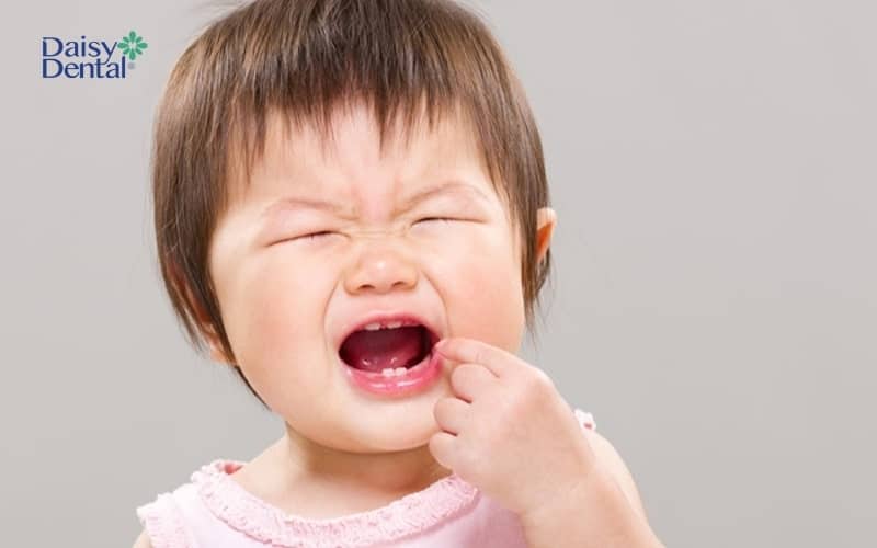 Sưng lợi mọc răng ở trẻ thường xảy ra từ 3 - 10 ngày