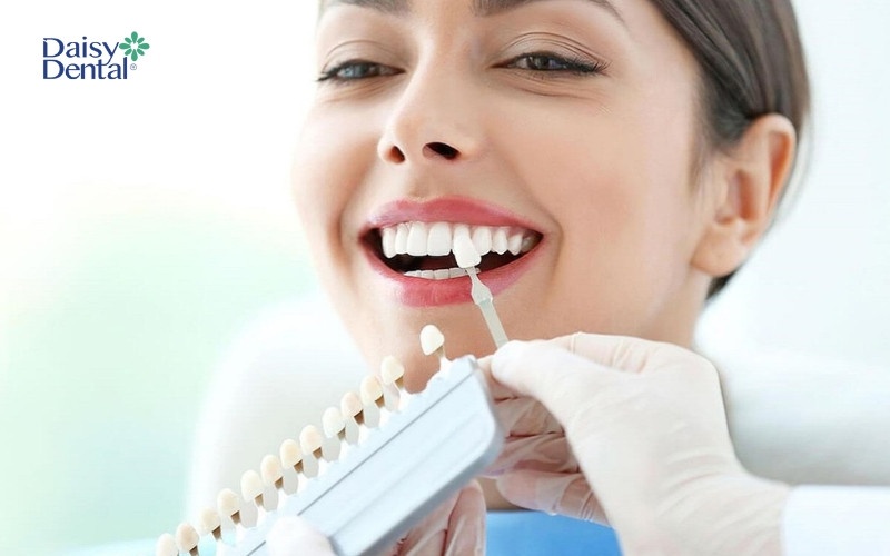 Tay nghề bác sĩ là yếu tố quyết định đến quy trình dán răng sứ Veneer có được thực hiện đúng hay không