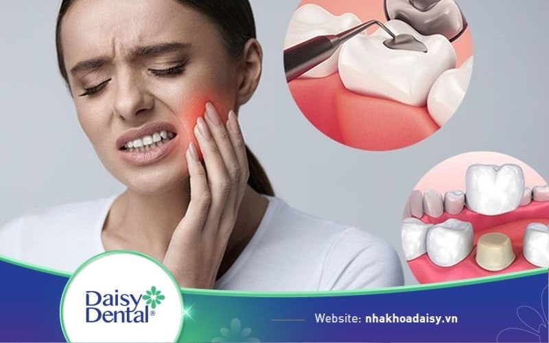 răng đã trám có bọc sứ được không