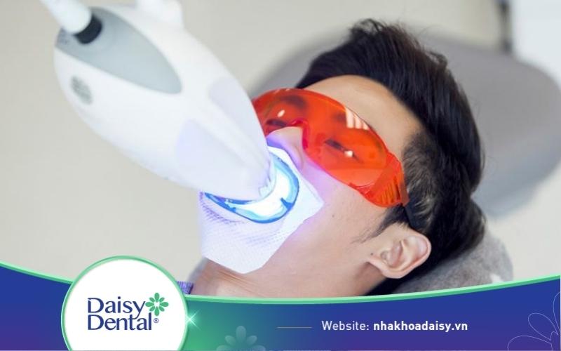tẩy trắng răng có hại không