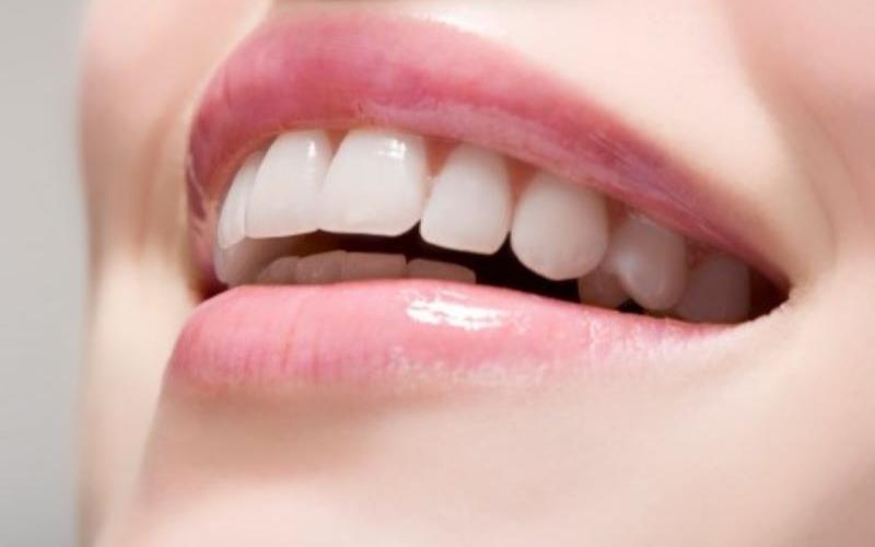 Tẩy trắng răng WhiteMax giúp răng trắng đẹp tự nhiên