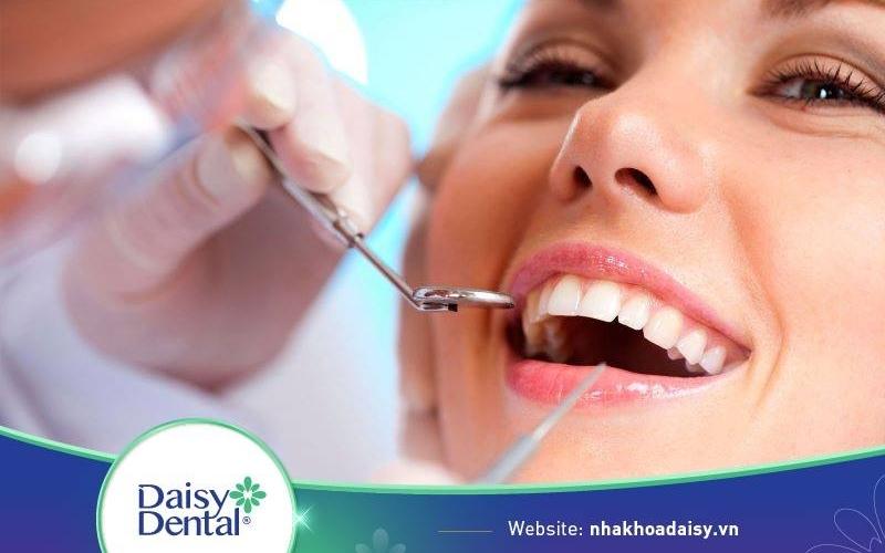 Lấy cao răng bằng máy siêu âm
