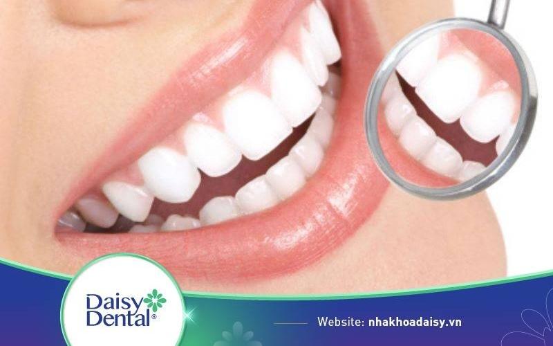 tẩy trắng răng whitemax
