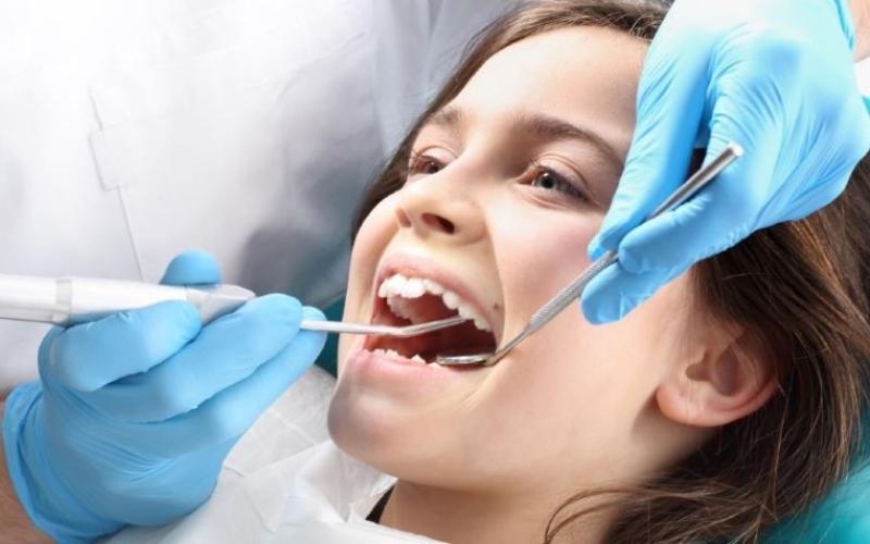 Trẻ em cũng cần được lấy cao răng như người lớn để làm sạch răng miệng
