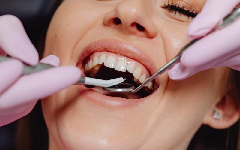 Chọn cơ sở nha khoa uy tín để nhổ răng khôn đảm bảo an toàn