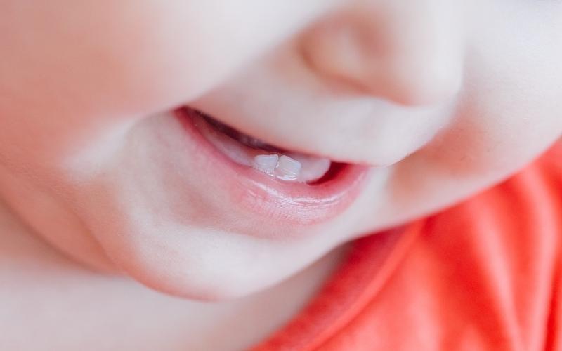 Trẻ 3 - 4 tuổi có 20 chiếc răng sữa