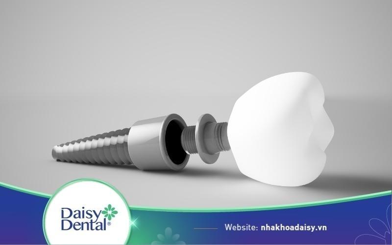 implant etk