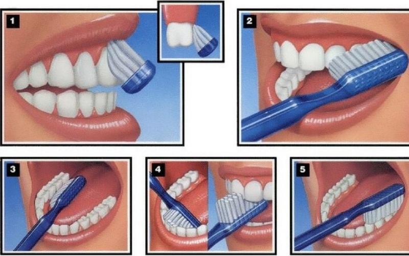 Cần chải răng đúng theo tiêu chuẩn y tế