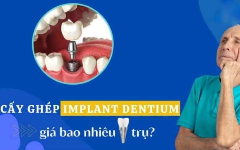 Chi phí cấy ghép trụ Implant Dentium hợp túi tiền