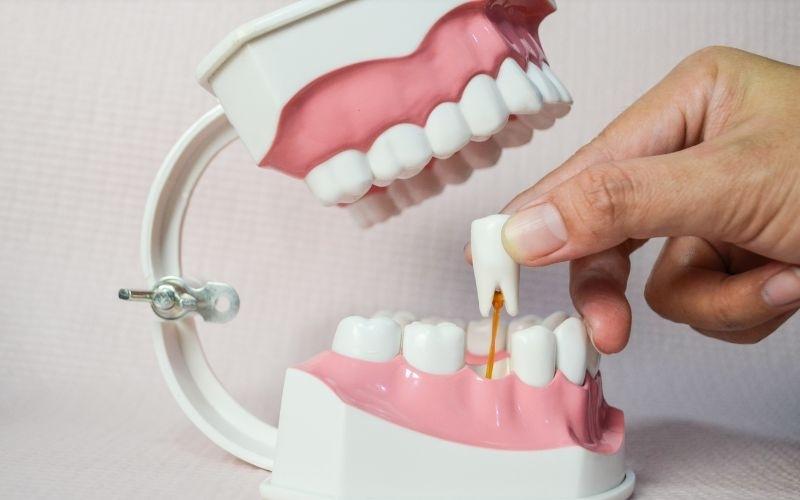 Mất răng là nguyên nhân chính khiến xương hàm dưới bị tiêu biến