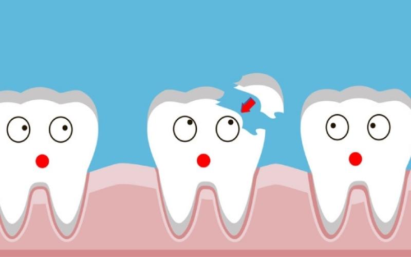 Men răng yếu có thể bị bong tróc khi nhai thức ăn