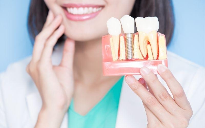Phương pháp trồng răng Implant 7 phút không đau