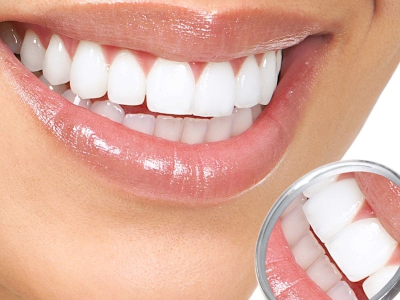 Người sở hữu hàm răng đều hạt bắp thường có vận mệnh tốt
