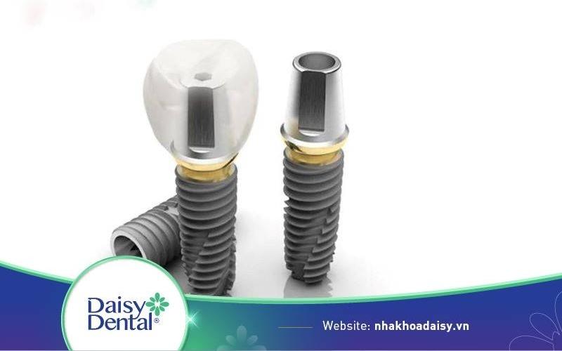 implant dentium