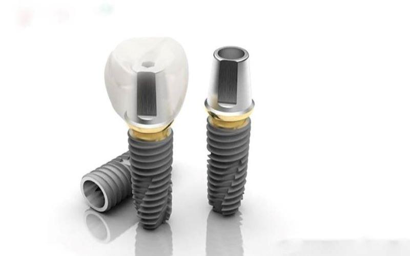Implant Dentium là loại trụ Implant được nhiều người lựa chọn