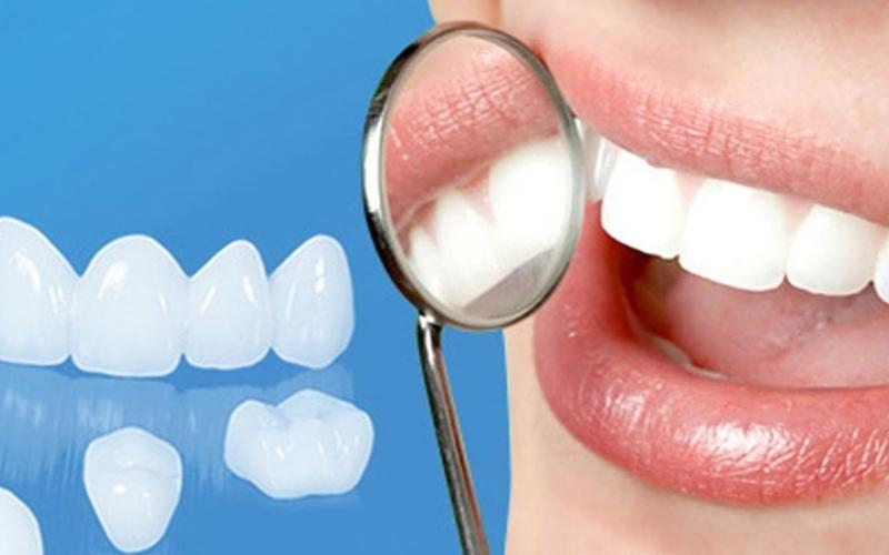 Vệ sinh đúng cách giúp bảo vệ răng sứ tốt hơn