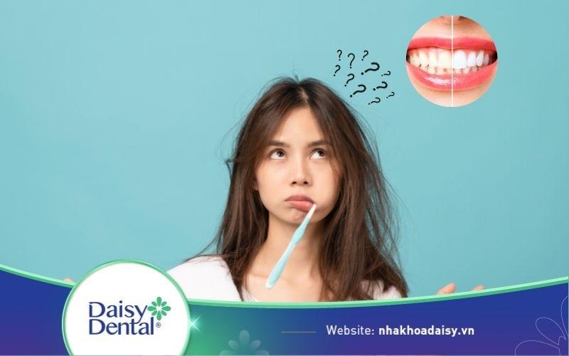 Tẩy trắng răng có nên đánh răng không