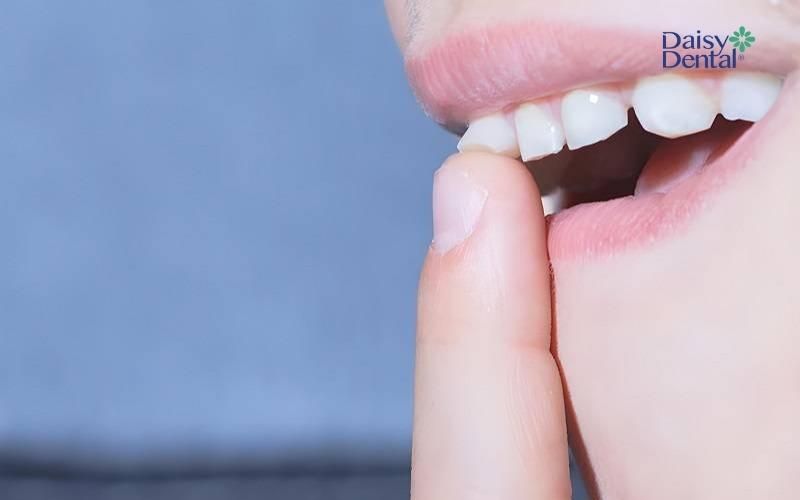 Mơ răng cửa bị lung lay có thể là điềm báo tốt lành