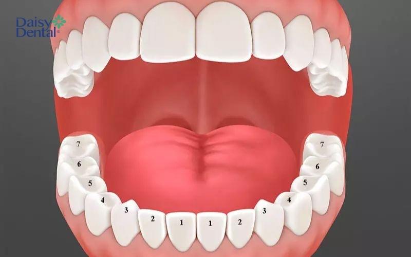 Người mọc thiếu 2 răng khôn hàm dưới