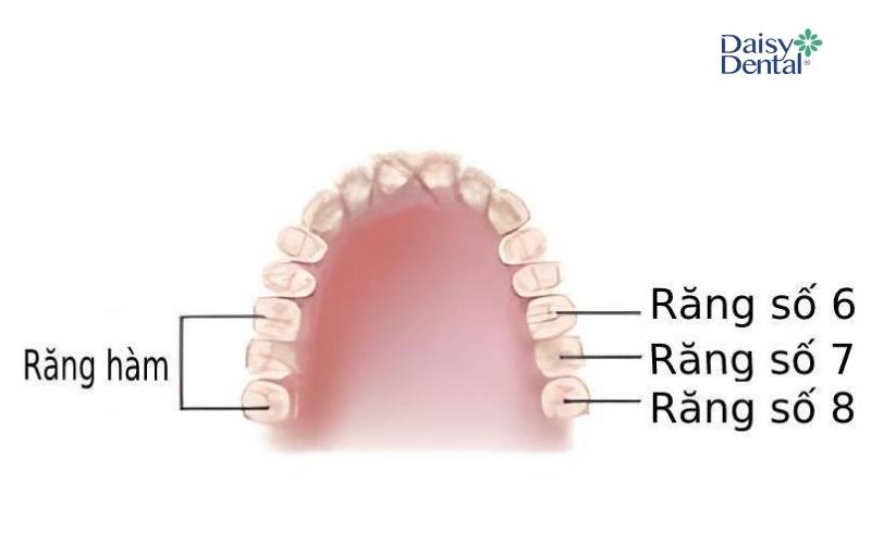 Nhóm răng hàm lớn gồm răng số 6, số 7 và số 8