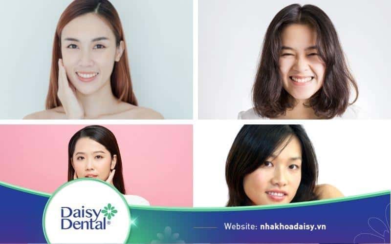 Các kiểu khuôn mặt