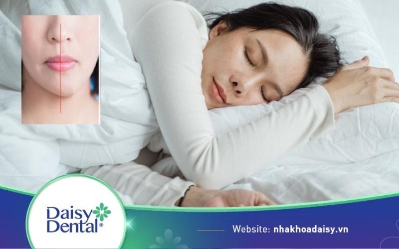 mặt lệch bên trái thì nằm nghiêng bên nào