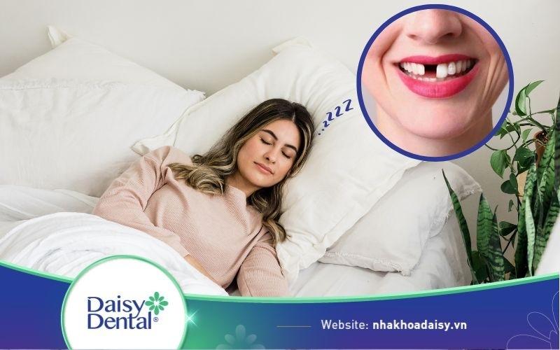 nằm mơ thấy rụng răng không chảy máu