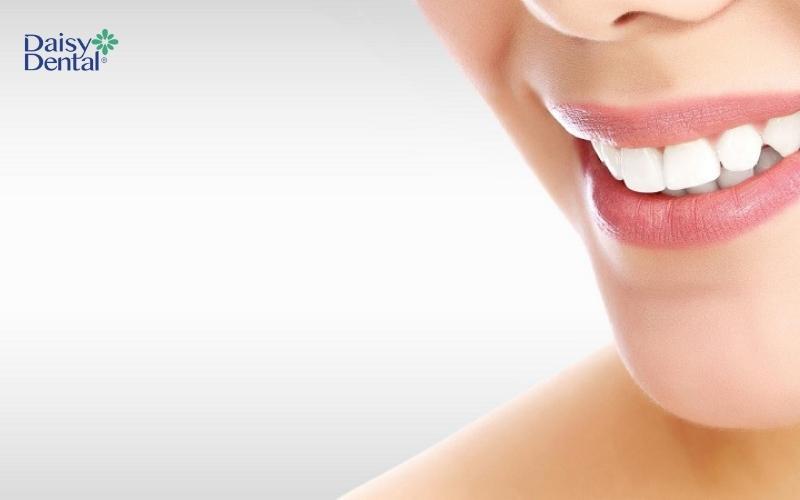 Bọc răng sứ là giải pháp được nhiều khách hàng lựa chọn