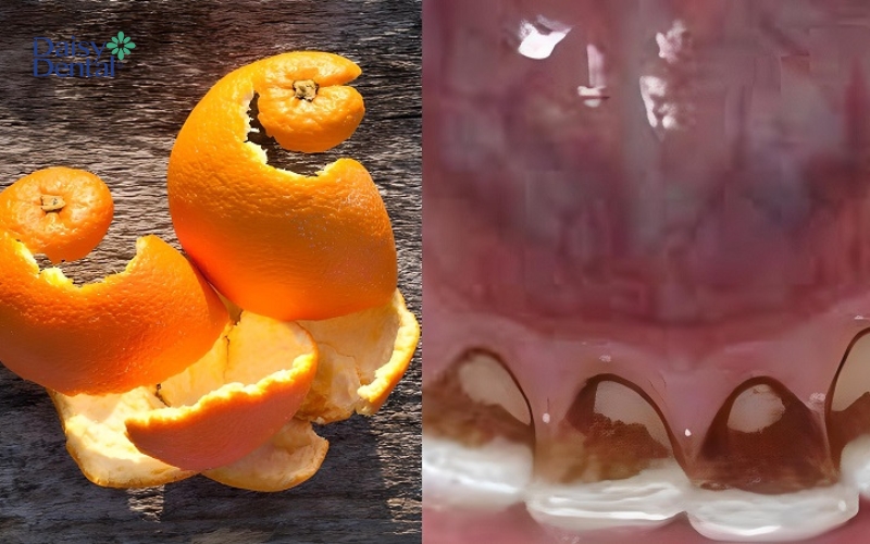 Dùng vỏ cam để làm sạch lớp mảng bám đậm màu trên răng