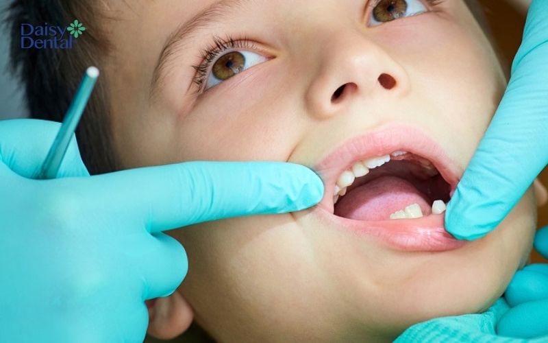 Đưa trẻ đến nha khoa để thăm khám định kỳ là cách bảo quản răng sữa tốt nhất