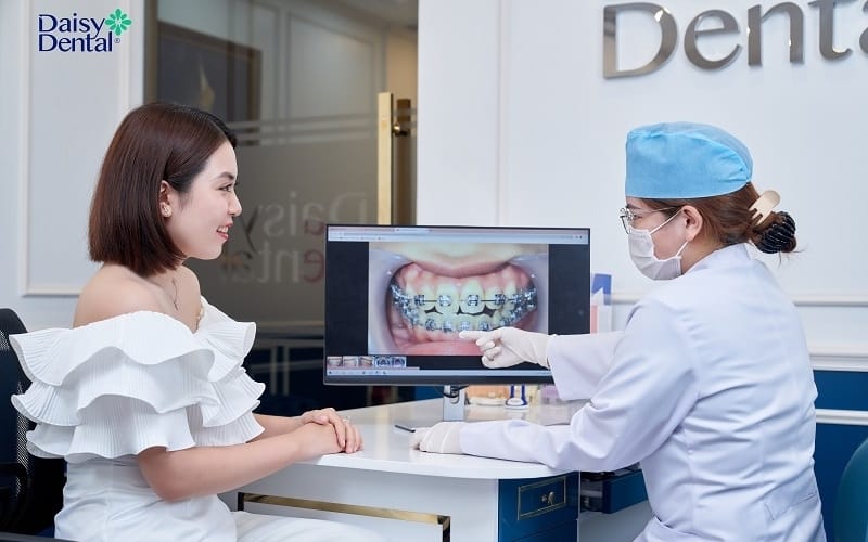 Niềng răng là phương pháp cải thiện tình trạng móm do răng an toàn, hiệu quả