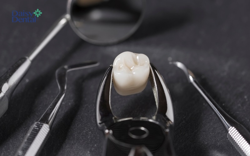 Nhổ bỏ răng khi răng bị tổn thương nghiêm trọng hoặc làm ảnh hưởng đến những chiếc răng khác